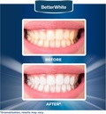 teeth-whitening-powder---hydroxyapatite--6.jpg